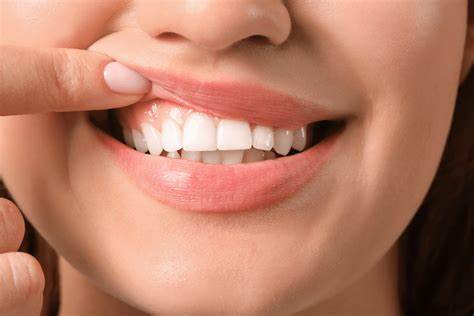Meilleure Brosse à dents électrique pour gencives qui se rétractent