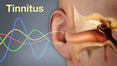 Les brosses à dents soniques peuvent-elles causer des acouphènes ?