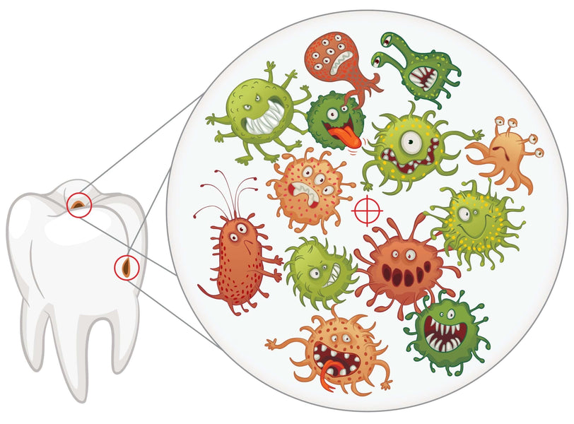 Comment une infection dentaire peut-elle rester non traitée ?