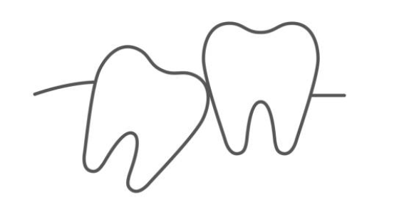 Est-ce que tout le monde a des dents de sagesse ?