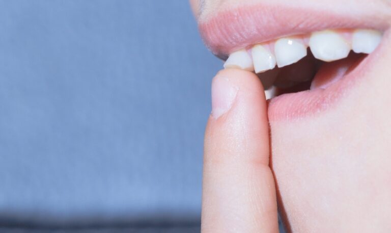 Comment resserrer une dent qui bouge à la maison ?